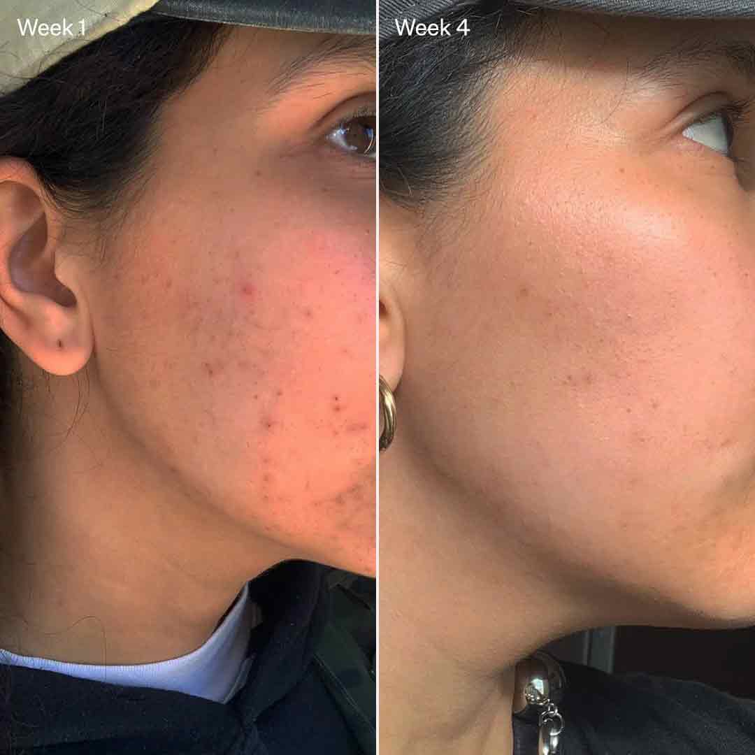 Pre & Probiotics Booster